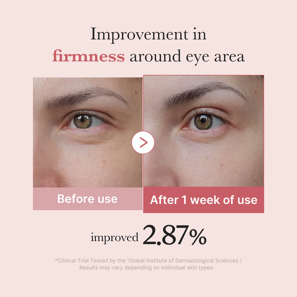 Крем для шкіри навколо очей з полінуклеотидами та пептидами Medicube PDRN Pink Peptide Eye Cream, 30 ml SP-477 фото